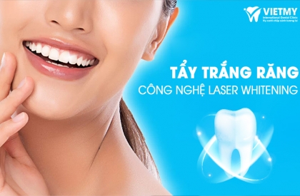Tẩy Trăng Răng Hiệu Quả Và An Toàn Với Công Nghệ Laser Whitening